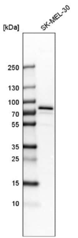 GYG2 Antibody, Novus Biologicals 0.1mL; Unlabeled:Antibodies, Polyclonal